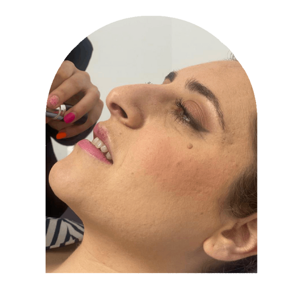 Mujer con tratamiento estético facial